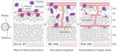 More than meets the eye: The role of microglia in healthy and diseased retina